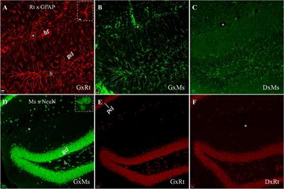 Blocking Cross-Species Secondary Binding When Performing Double Immunostaining With Mouse and Rat Primary Antibodies